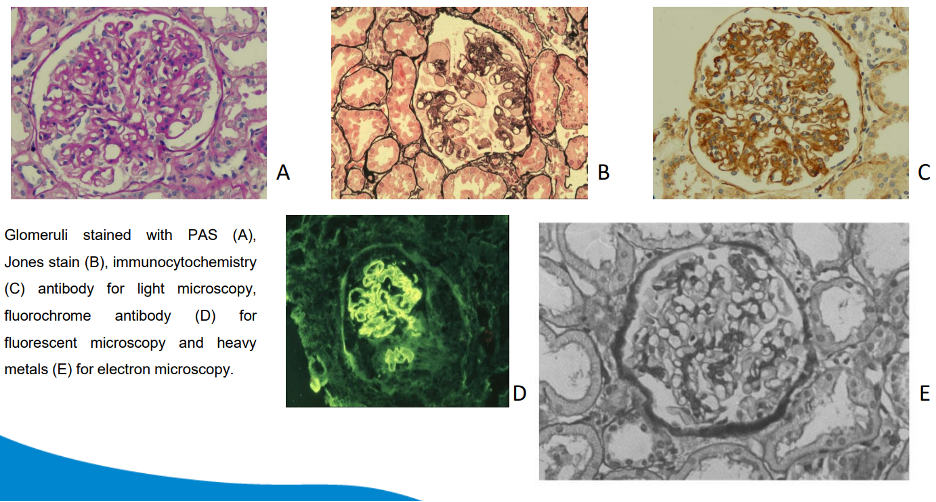 Histopathology staining and microscopy images shown in the laboratory report
