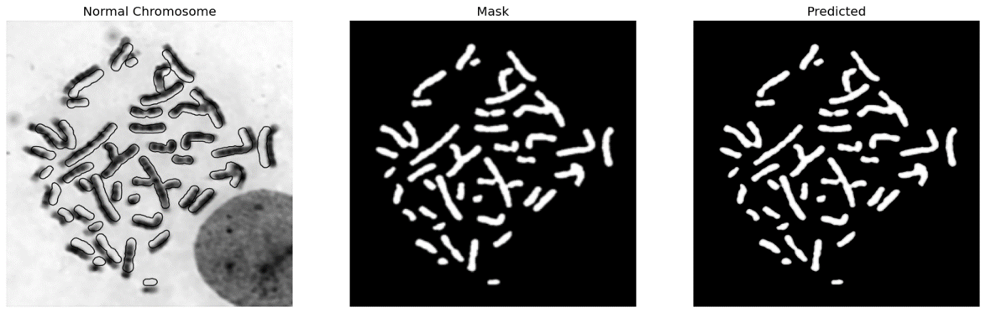 Figure 16 : Sample Normal and abnormal images of chromosome; (a ) and (b) Normal chromosome , mask and predicted images; (c) and (d) Abnormal chromosome, mask and predicted images.
