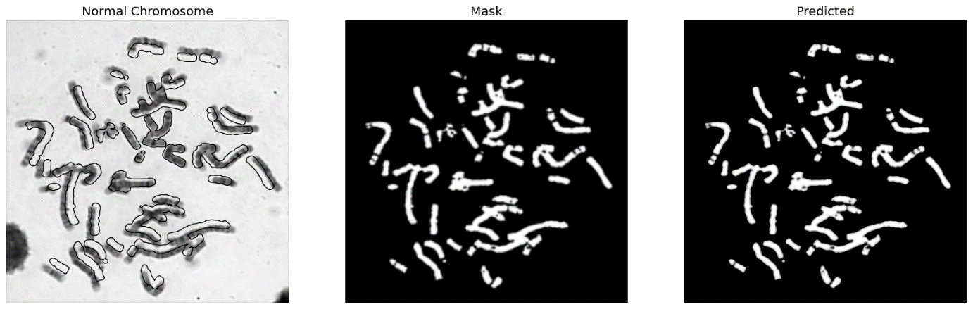Figure 16 : Sample Normal and abnormal images of chromosome; (a ) and (b) Normal chromosome , mask and predicted images; (c) and (d) Abnormal chromosome, mask and predicted images.