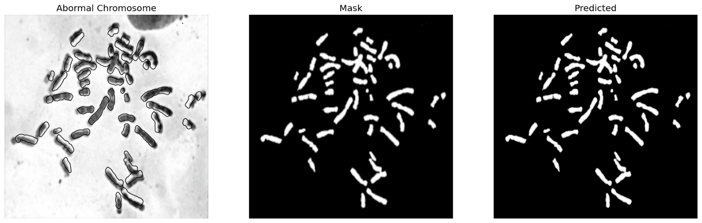 Figure 16 : Sample Normal and abnormal images of chromosome; (a ) and (b) Normal chromosome , mask and predicted images; (c) and (d) Abnormal chromosome, mask and predicted images.