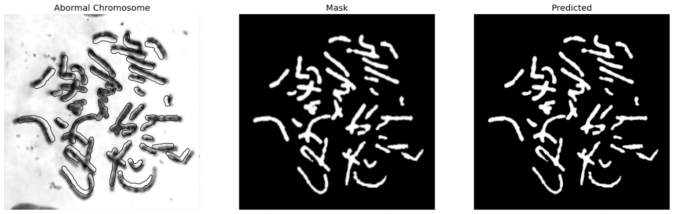 Figure 16 : Sample Normal and abnormal images of chromosome; (a ) and (b) Normal chromosome , mask and predicted images; (c) and (d) Abnormal chromosome, mask and predicted images.