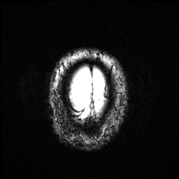Figure 6: AD (a) MRI (b) PET