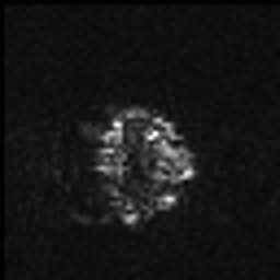 Figure 6: AD (a) MRI (b) PET