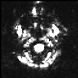 Figure 7: CN (a) MRI (b) PET