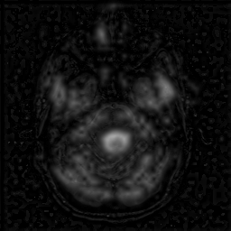Figure 9: Pre-processed images (a) MRI (b) PET