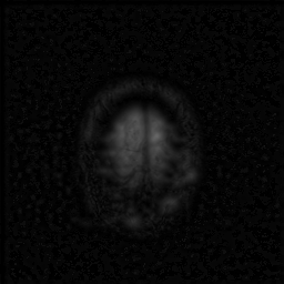 Figure 9: Pre-processed images (a) MRI (b) PET