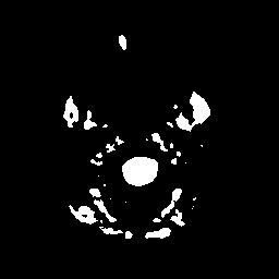 Figure 10: Segmented images (a) MRI (b) PET