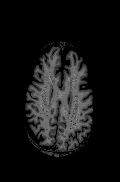 Figure 7: (a) original image (b) pre-processed image (c) classified image