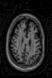Figure 7: (a) original image (b) pre-processed image (c) classified image