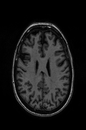 Figure 7: (a) original image (b) pre-processed image (c) classified image