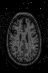 Figure 7: (a) original image (b) pre-processed image (c) classified image