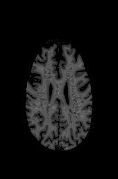 Figure 7: (a) original image (b) pre-processed image (c) classified image